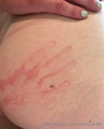chelicer69