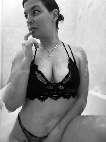 Freckledface87