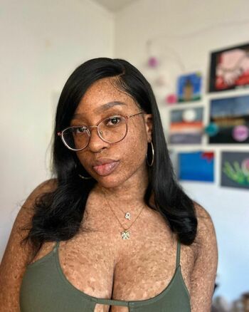 freckledn