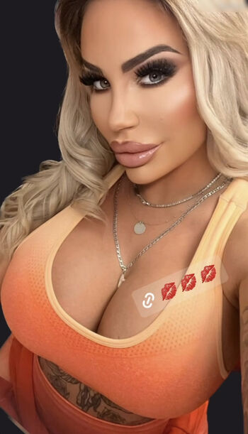 Gina-Lisa Lohfink