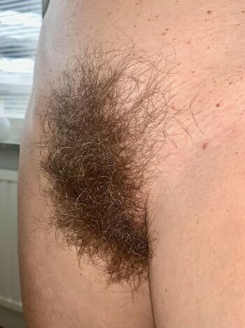 Hairy Women