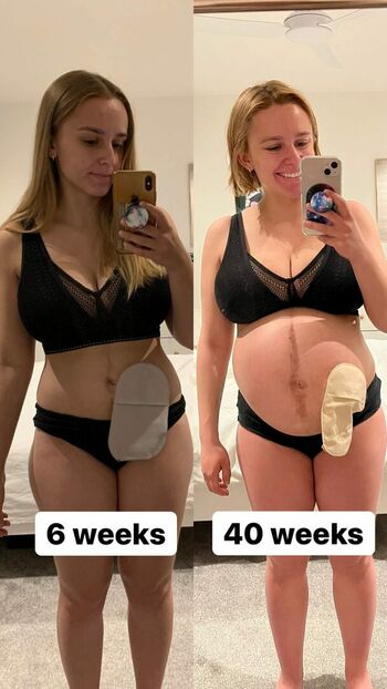 Hannah Witton