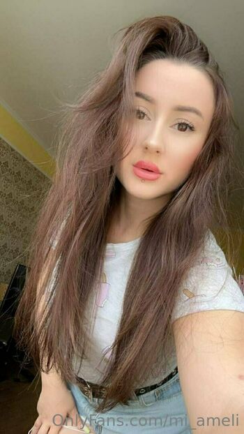 mi_ameli