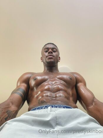 prettyskinboi