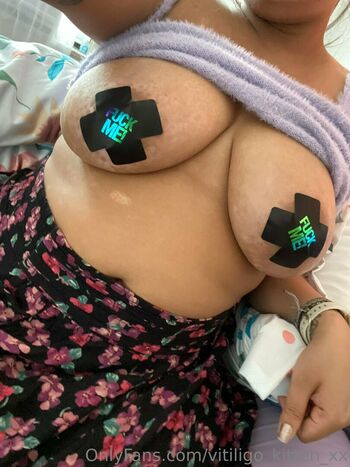 vitiligo_kitten_xx