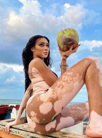 Winnie Harlow