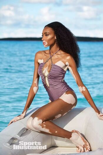 Winnie Harlow