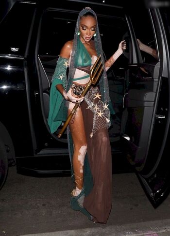 Winnie Harlow