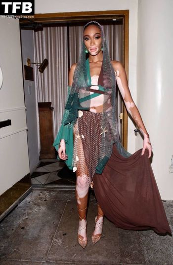 Winnie Harlow