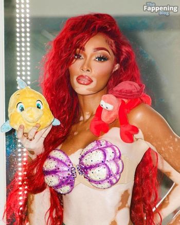 Winnie Harlow